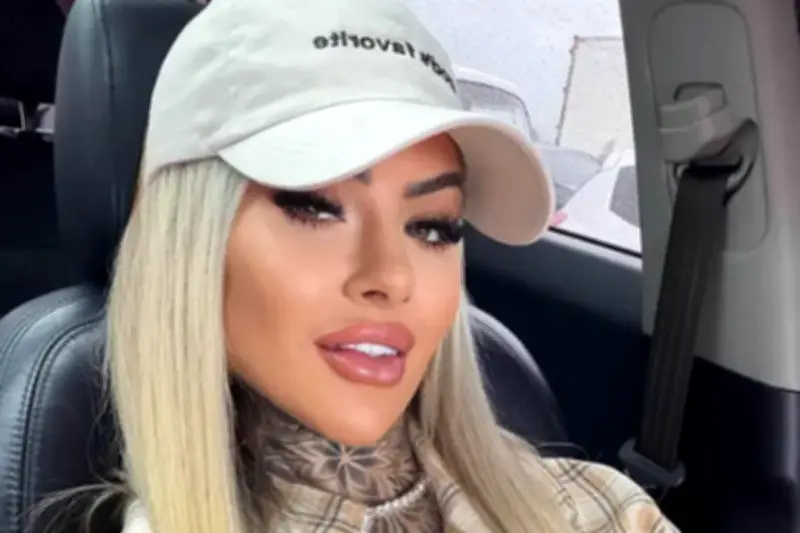 Kreator Konten Bianca Dias Meninggal Usai Operasi Plastik, Diduga Emboli Paru