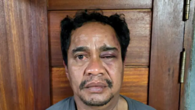 Bandar Narkoba Jaringan Ko Erwin Ditangkap, Aliran Rp1,6 M ke AKP Malaungi Terungkap