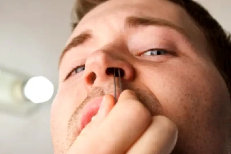 Benarkah Mencabut Bulu Hidung Bisa Sebabkan Radang Otak dan Kematian?