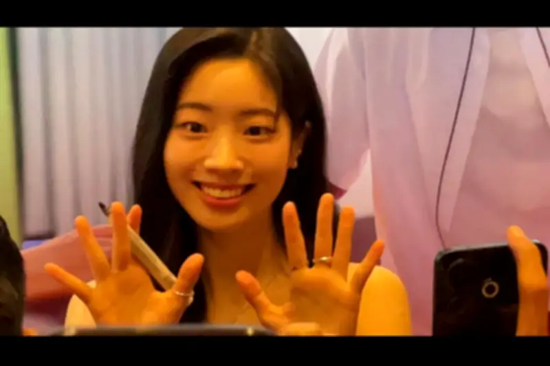 Dahyun TWICE Hentikan Sementara Aktivitas Demi Pemulihan Cedera Pergelangan Kaki