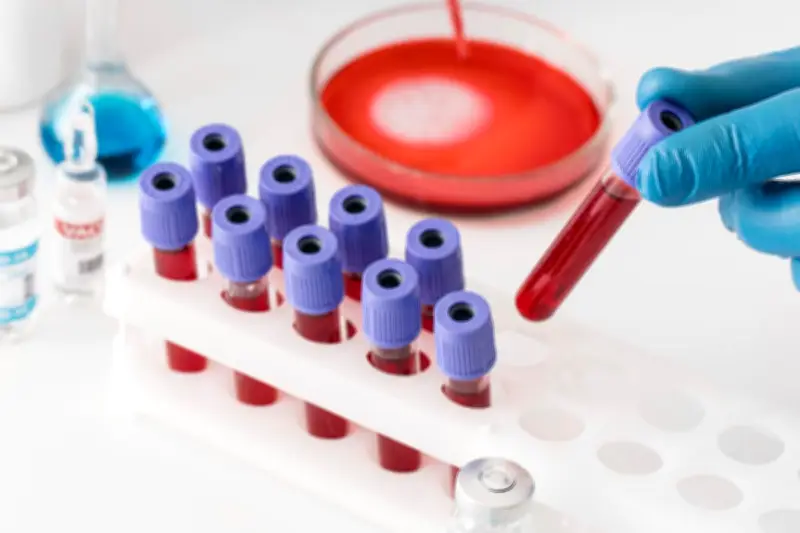 Golongan Darah B Berisiko 28 Persen Lebih Tinggi Terkena Diabetes Tipe 2