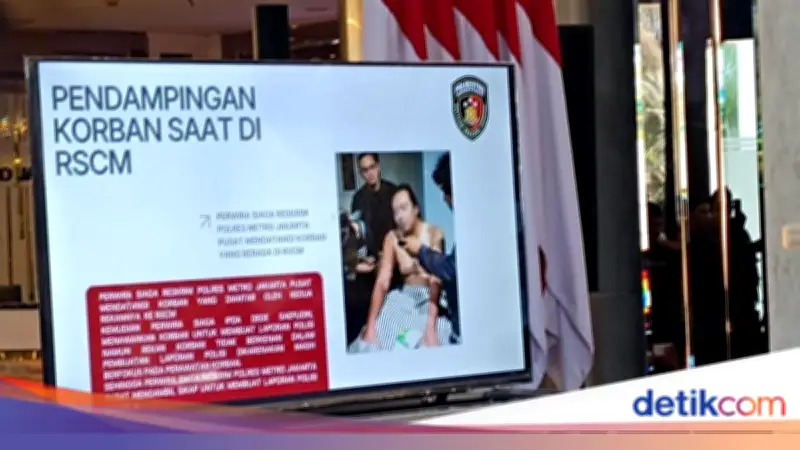 Kondisi Andrie Yunus Sudah Stabil, RSCM Pastikan Tidak Mengancam Jiwa