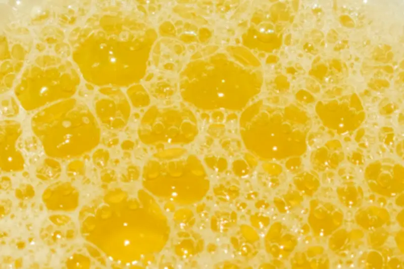 Pemeriksaan Urine Penting untuk Deteksi Dini Radang Ginjal di Usia Muda