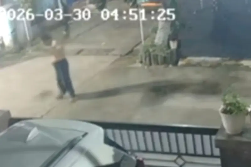 Pria di Bekasi Jadi Korban Penyiraman Air Keras, Alami Luka Bakar 30 Persen