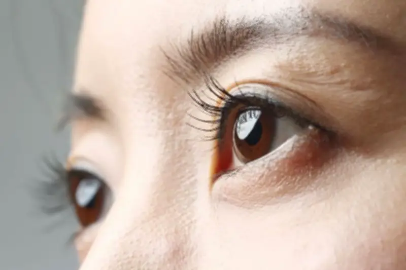 Ahli Peringatkan Risiko Angkat Beban bagi Pemilik Mata Minus Tinggi di Atas -5.00