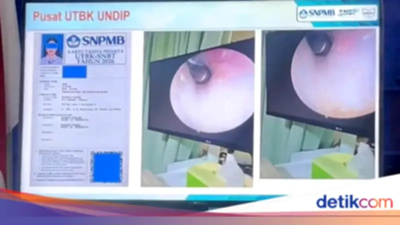 Peserta UTBK Undip Ketahuan Curang dengan Alat Bantu di Telinga, Dibawa ke Polsek