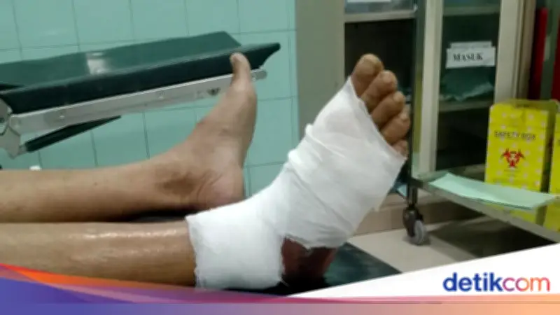 Pria di Brebes Digigit Ular Viper Saat Cari Rumput, Kaki Melepuh Parah