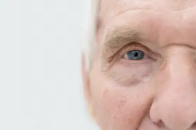 Kemenkes: 600-650 Ribu Kasus Kebutaan Akibat Katarak Sepanjang 2025