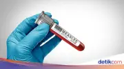 Wabah Campak Banten: 4.456 Suspek, 157 Positif, dan 6 Korban Meninggal