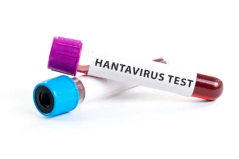 Hantavirus Bukan Flu Biasa, Tingkat Kematian Capai 40 Persen