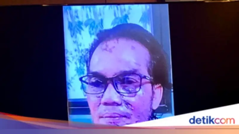 Sidang Penyiraman Air Keras ke Andrie Yunus: Oditur Tampilkan Foto Luka Terdakwa