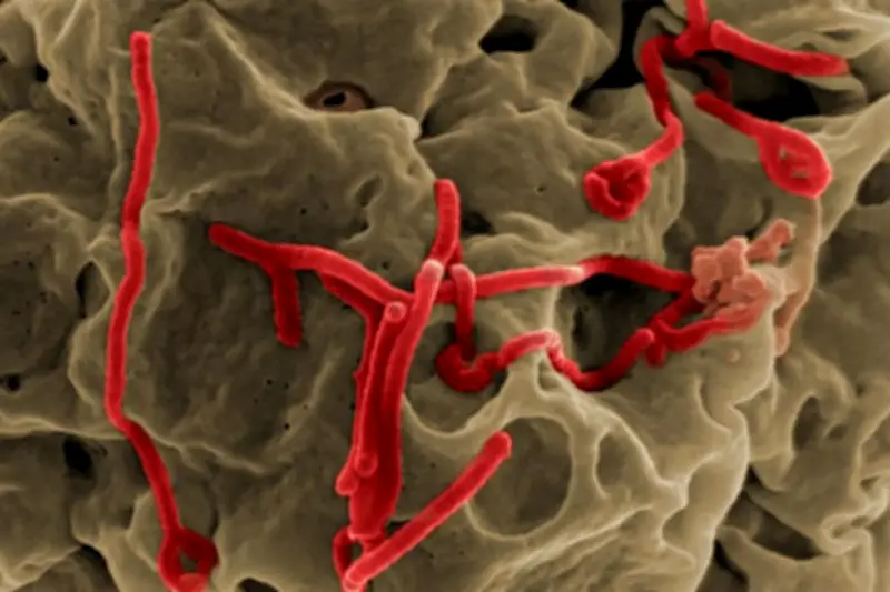 Wabah Ebola di Kongo: 246 Kasus, 80 Meninggal, Menyebar ke Uganda