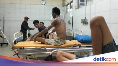 Pria di Tasik Siram Air Keras ke 9 Pegawai Konveksi, Pelaku Ditangkap