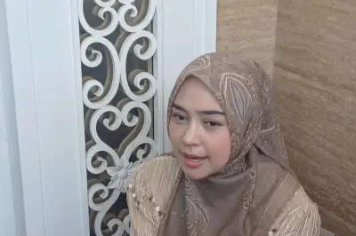Ria Ricis Operasi Hidung karena Sulit Bernapas, Bukan Sekadar Estetika