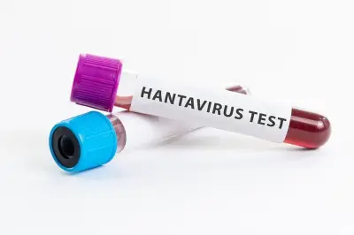 Wabah Hantavirus di Kapal MV Hondius, 3 Tewas dan 11 Terinfeksi