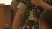 Bekas Luka Hitam di Tubuh Penyiram Air Keras Andrie Yunus Masih Terlihat