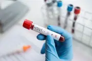 CDC Konfirmasi Kasus Pertama Flu Burung H5N1 dari Kucing ke Manusia