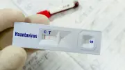 Warga Kulon Progo Suspek Virus Hanta Dinyatakan Negatif