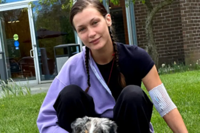 Bella Hadid Emosional Lawan Kambuhnya Penyakit Lyme