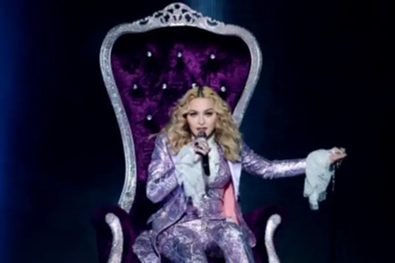 Madonna Blak-blakan: Tak Punya Tulang Rawan di Lutut Akibat Karier