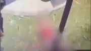 Bocah 6 Tahun Koma Usai Kesetrum Tiang Listrik Diduga Dibully Dua Remaja