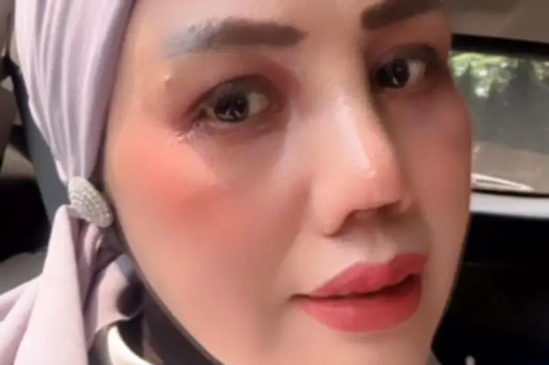 Elly Sugigi Tak Dapat Restu Anak Saat Operasi Plastik