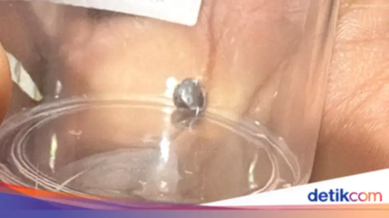 Polisi Selidiki Asal-usul Proyektil Senapan Angin yang Lukai Bocah di Bekasi