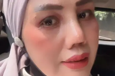 Elly Sugigi Tak Dapat Restu Anak Saat Operasi Plastik